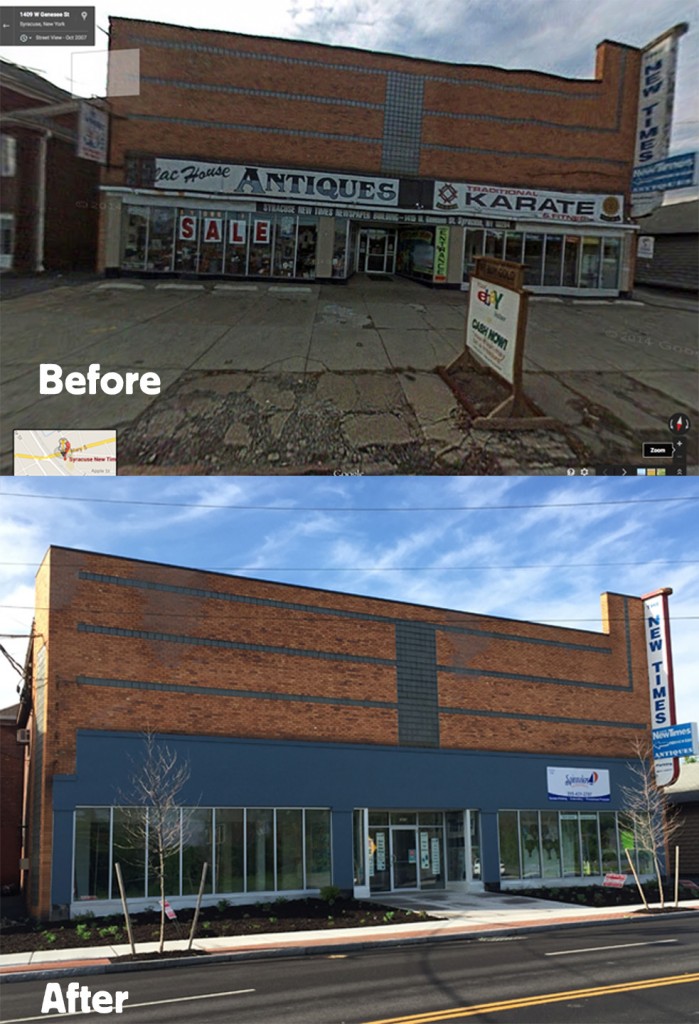 BeforeAfterSNT